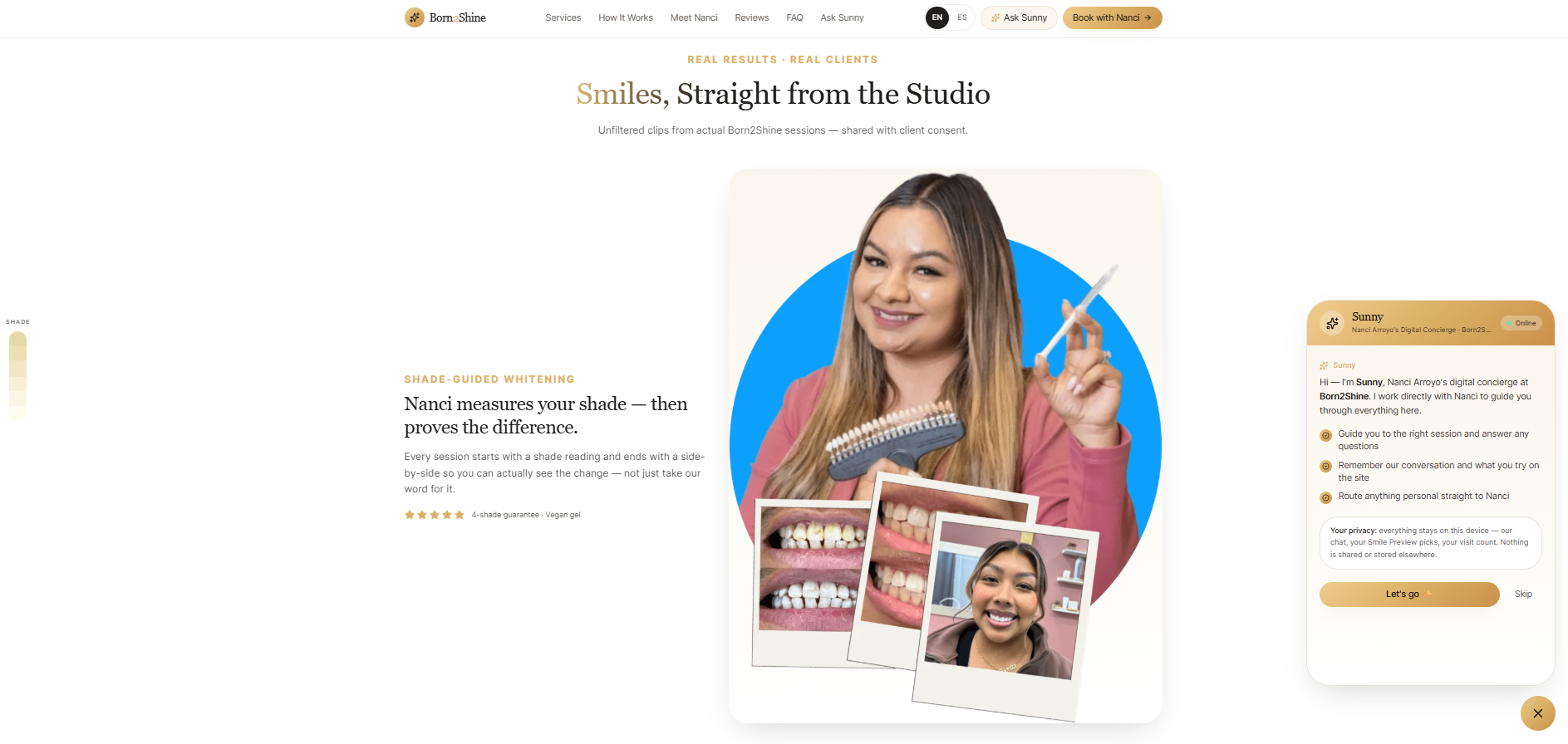 Born2Shine — Shade-Guided Whitening